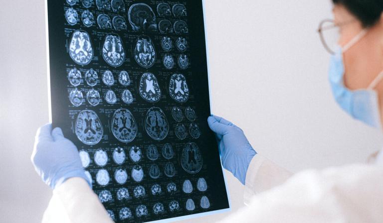 Neuroplasticidade e neurónios